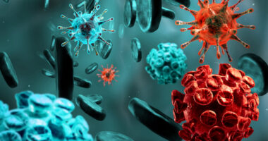 Gaucher disease and blood cancer