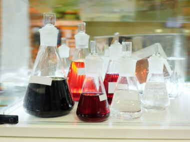 Gaucher enzyme test