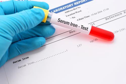 High Levels of Iron During Therapy Linked to Residual Gaucher Disease, Study Finds