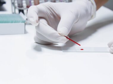 Gaucher treatment tracker