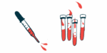 This illustration shows a blood-filled dropper next to four vials of blood.