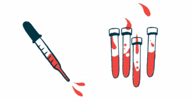 This illustration shows a blood-filled dropper next to four vials of blood.