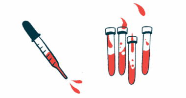 This illustration shows a blood-filled dropper next to four vials of blood.
