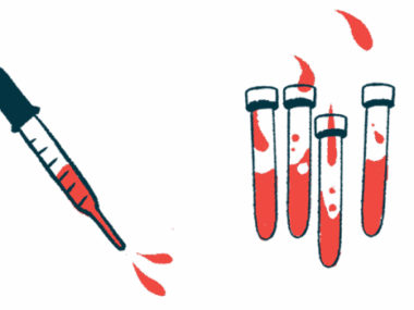 A dropper squirting blood is seen next to four half-filled vials.