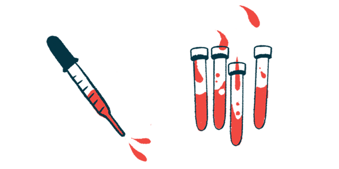 This illustration shows a blood-filled dropper next to four vials of blood.