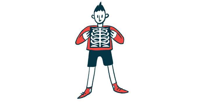 An illustration of a man standing, holding a square, dark X-ray film over their chest, which reveals a depiction of a ribcage and spine against the black background of the film.